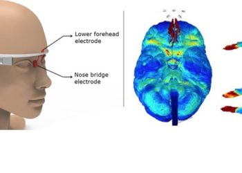 Google Glass-like device could zap Alzheimer's disease