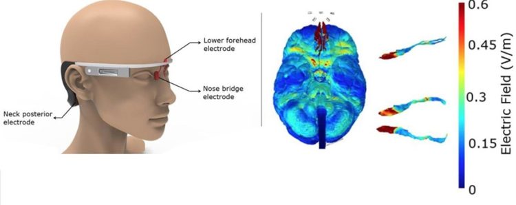 Google Glass-like device could zap Alzheimer's disease