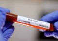 40 medical college students test positive