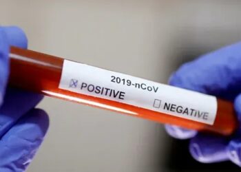 Car used by Waze was parked outside Sena MLA’s office: Rane