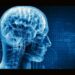 Study reveals differences between men and women's brains