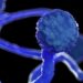 Don't panic by colour of fungus, look for causes, risks: Experts advise as mucormycosis cases rise