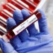 Delhi reports 231 new Covid cases, lowest since March 2