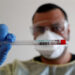 Get screened every six months after your Covid recovery