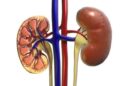 Long COVID complications causing severe kidney damage, say doctors
