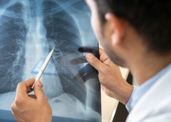 Firozabad dengue outbreak: UP Chief Minister orders action against lax officials