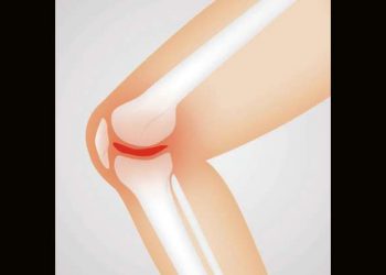 Knee replacement surgeries fell 40pc in India due to Covid: Experts