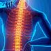 Normality is back, so are lifestyle-related spine issues