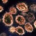 Scientists identify second HIV patient whose body likely rid itself of virus