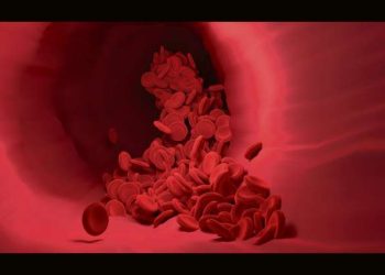 Study finds exposure to toxic metals may lead to clogged arteries