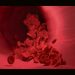 Study finds exposure to toxic metals may lead to clogged arteries