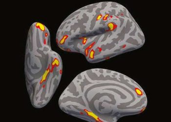 Covid, a cause for neural tissue damage