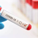 Delhi reports 403 fresh Covid cases, 1 death