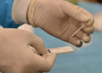 Studies report acute hepatitis among Indian children during Covid