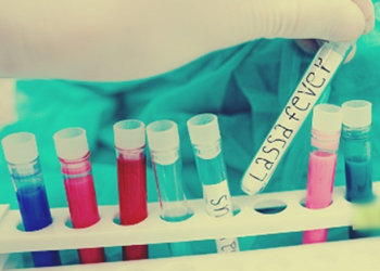 Lassa fever death toll reaches 155 in Nigeria