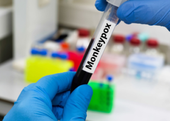 Monkeypox: Fear of stigma affecting public health response