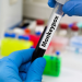 Monkeypox: Fear of stigma affecting public health response