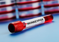 Monkeypox may become endemic in US wild animals: Report