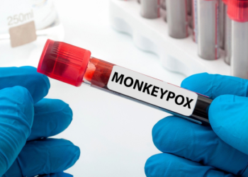 Monkeypox virus can persist in semen for weeks after recovery: Lancet