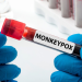 Monkeypox virus can persist in semen for weeks after recovery: Lancet