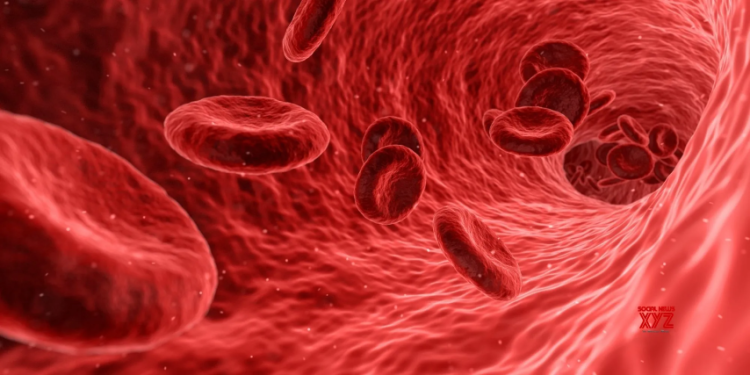 Study provides more evidence on very rare blood-clotting after Covid vaccination