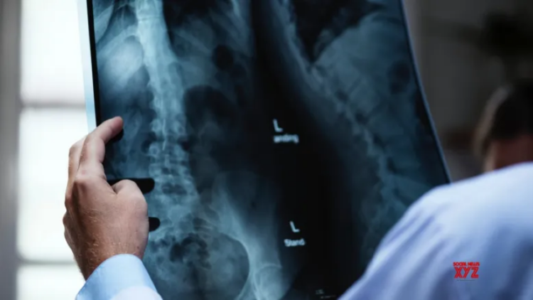 Experts discuss advances in spinal cord injury care, rehab