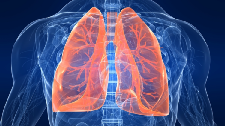 Researchers tests AI tool that predicts risk of lung cancer