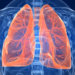 Researchers tests AI tool that predicts risk of lung cancer
