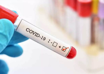 Covid-19 pandemic a result of lab leak: US agency