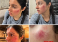 Divya Khosla Kumar Injured During Shooting Of Her Next