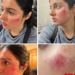 Divya Khosla Kumar Injured During Shooting Of Her Next
