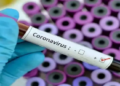 Covid patients’ blood plasma may predict severity, death: Study