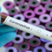 Covid patients’ blood plasma may predict severity, death: Study