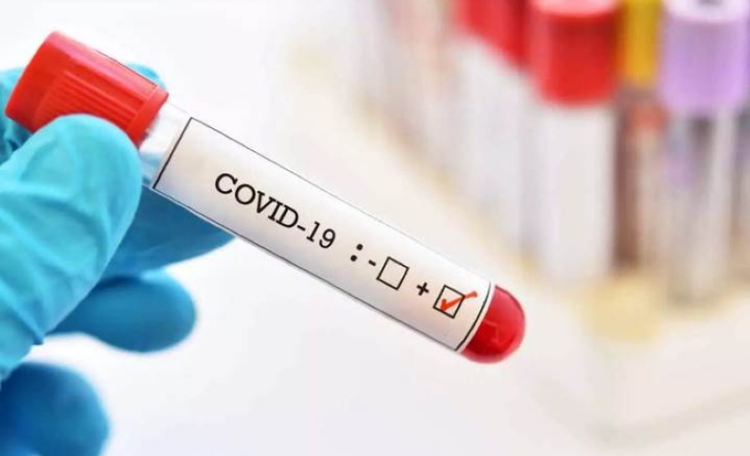New method for early detection of SARS-CoV-2 infection