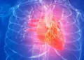 Fatal heart condition ‘spontaneously reversed’ in 3 men, shows study