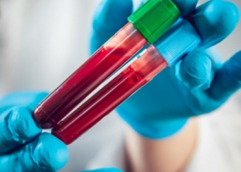 New blood test to detect 50 types of cancer shows promise