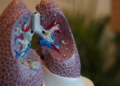 New lung cancer pill cuts risk of death by half