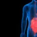 Urbanisation driving inflammatory bowel disease in young Indians: Lancet