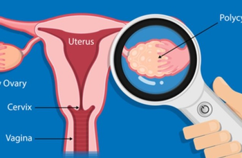 Ovarian cancer patients can benefit from personalised vaccine, adoptive T cell therapy: Study