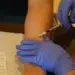 Monkeypox cases spread to 5 provinces in Indonesia