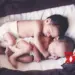 Twins born prematurely at 24 weeks brave hernia, heart defect to survive