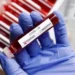 Covid-19 variant KP.3.1.1 predominant in US as infections continue ticking up