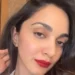 Kiara Advani flaunts hot red lipstick, fans speculate ‘lip filler’
